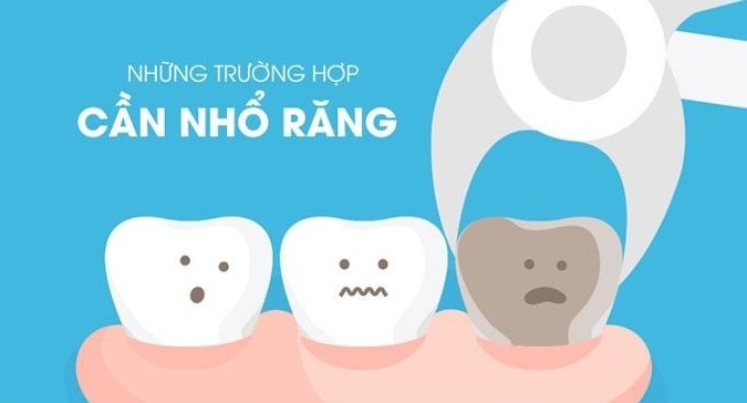 nho-rang-duoc-chi-dinh