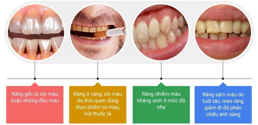 khi-nao-nen-tay-trang-rang