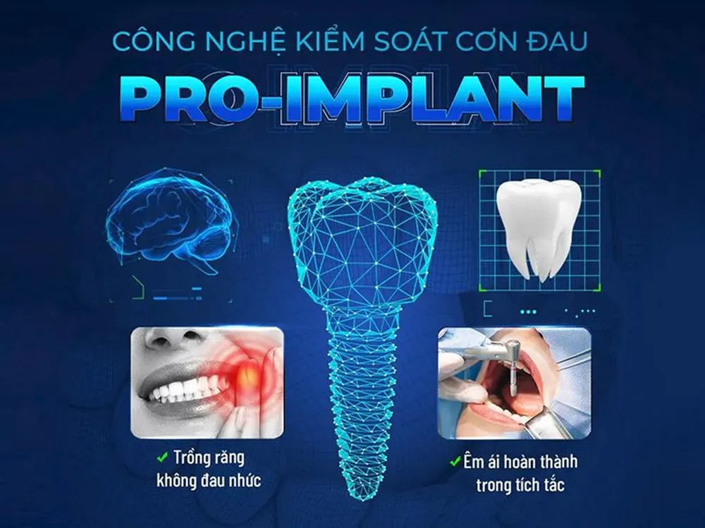 cay-ghep-implant-truyen-thong