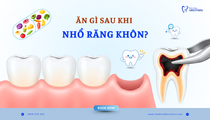 an-gi-sau-khi-nho-rang-khon