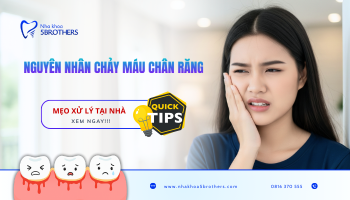 nguyen-nhan-chay-mau-chan-rang