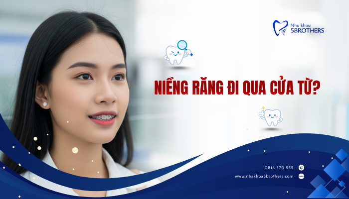 nieng-rang-di-qua-cua-tu-co-sao-khong