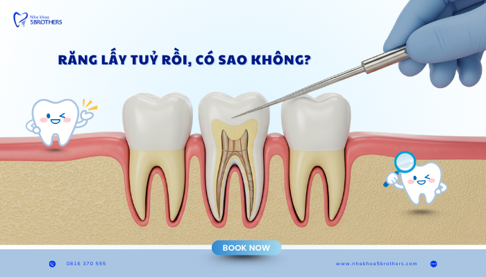 rang-lay-tuy-roi-co-sao-khong