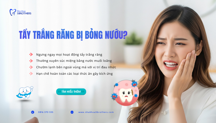 tay-trang-rang-bi-bong-nuou