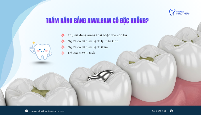tram-rang-bang-amalgam-co-doc-khong