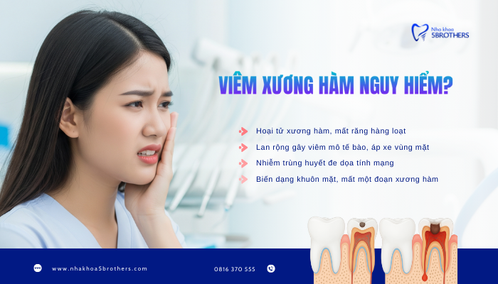 viem-xuong-ham-nguy-hiem